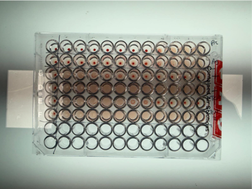 Louping -ill Blood Test Set Up In The Laboratory Louping -ill Blood Test Set Up In The Laboratory